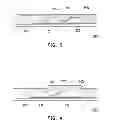 Fig. 04 - Electronic device