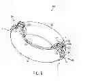 Fig. 08 - HARP MOUNTING SYSTEM