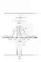 Fig. 04 - FEED FORWARD SIGNAL CANCELLATION