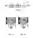 Fig. 06 - Video decoding apparatus and method for enhancing video quality