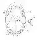 Fig. 01 - Actuator systems for oral-based appliances