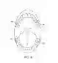Fig. 10 - Actuator systems for oral-based appliances