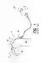 Fig. 02 - Speech processor cases