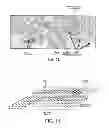 Fig. 07 - Gleason grading by segmenting and combining co-registered images of differently stained tissue slices