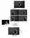 Fig. 08 - Distance metric for image comparison