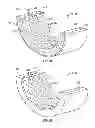 Fig. 03 - Self-lubricating snubber bearing