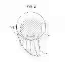 Fig. 04 - Journal Bearing Device