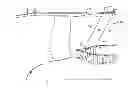 Fig. 01 - Overmolded vane platform