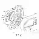 Fig. 07 - FUEL PUMP