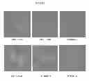 Fig. 07 - Integrin targeting agents and in-vivo and in-vitro imaging methods using the same
