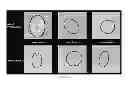 Fig. 10 - THERAPEUTIC METHODS AND COMPOSITIONS FOR SOLID DELIVERY