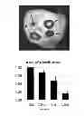 Fig. 11 - THERAPEUTIC METHODS AND COMPOSITIONS FOR SOLID DELIVERY