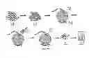 Fig. 20 - THERAPEUTIC METHODS AND COMPOSITIONS FOR SOLID DELIVERY