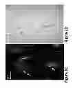 Fig. 04 - NON-INVASIVE IMAGING METHODS FOR PATIENT SELECTION FOR TREATMENT WITH NANOPARTICULATE THERAPEUTIC AGENTS