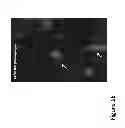 Fig. 05 - NON-INVASIVE IMAGING METHODS FOR PATIENT SELECTION FOR TREATMENT WITH NANOPARTICULATE THERAPEUTIC AGENTS