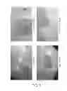 Fig. 06 - Anti-nucleolin agent-conjugated nanoparticles