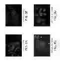 Fig. 07 - Anti-nucleolin agent-conjugated nanoparticles