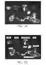 Fig. 15 - Anti-nucleolin agent-conjugated nanoparticles