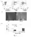 Fig. 03 - METHOD OF TREATING ISCHEMIC DISORDERS