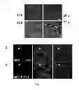 Fig. 04 - METHOD OF TREATING ISCHEMIC DISORDERS