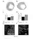 Fig. 13 - METHOD OF TREATING ISCHEMIC DISORDERS