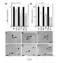 Fig. 06 - Compositions and methods related to antibodies to staphylococcal protein A