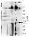 Fig. 11 - COMPOSITIONS AND METHODS OF USE FOR MGD-CSF IN DISEASE TREATMENT