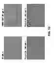 Fig. 28 - COMPOSITIONS AND METHODS OF USE FOR MGD-CSF IN DISEASE TREATMENT