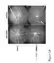 Fig. 06 - METHODS AND COMPOSITIONS FOR TREATING CONDITIONS ASSOCIATED WITH ANGIOGENESIS USING A VASCULAR ADHESION PROTEIN-1 (VAP-1) INHIBITOR