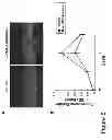 Fig. 08 - METHODS AND COMPOSITIONS FOR TREATING CONDITIONS ASSOCIATED WITH ANGIOGENESIS USING A VASCULAR ADHESION PROTEIN-1 (VAP-1) INHIBITOR