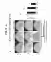 Fig. 14 - METHODS AND COMPOSITIONS FOR TREATING CONDITIONS ASSOCIATED WITH ANGIOGENESIS USING A VASCULAR ADHESION PROTEIN-1 (VAP-1) INHIBITOR