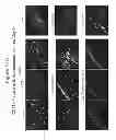Fig. 15 - METHODS AND COMPOSITIONS FOR TREATING CONDITIONS ASSOCIATED WITH ANGIOGENESIS USING A VASCULAR ADHESION PROTEIN-1 (VAP-1) INHIBITOR