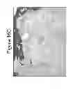 Fig. 23 - METHODS AND COMPOSITIONS FOR TREATING CONDITIONS ASSOCIATED WITH ANGIOGENESIS USING A VASCULAR ADHESION PROTEIN-1 (VAP-1) INHIBITOR