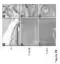 Fig. 26 - METHODS AND COMPOSITIONS FOR TREATING CONDITIONS ASSOCIATED WITH ANGIOGENESIS USING A VASCULAR ADHESION PROTEIN-1 (VAP-1) INHIBITOR
