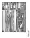 Fig. 32 - METHODS AND COMPOSITIONS FOR TREATING CONDITIONS ASSOCIATED WITH ANGIOGENESIS USING A VASCULAR ADHESION PROTEIN-1 (VAP-1) INHIBITOR