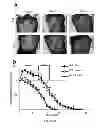 Fig. 12 - Methods of generating hyper iNOS expressing cells and uses thereof