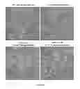 Fig. 24 - Methods of generating hyper iNOS expressing cells and uses thereof