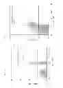 Fig. 02 - Treatment method for relapsing-remitting multiple sclerosis