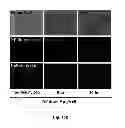 Fig. 19 - Uniform field magnetization and targeting of therapeutic formulations