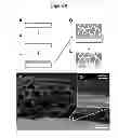 Fig. 09 - Multilayer thin film drug delivery device and methods of making and using the same