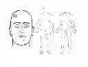 Fig. 01 - Compositions and methods for treating traumatic brain injury