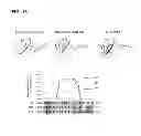 Fig. 17 - Methods for screening inhibitors of tumor associated protein aggregation