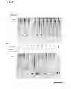 Fig. 24 - Methods for screening inhibitors of tumor associated protein aggregation