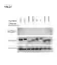 Fig. 26 - Methods for screening inhibitors of tumor associated protein aggregation