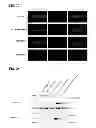 Fig. 33 - Methods for screening inhibitors of tumor associated protein aggregation