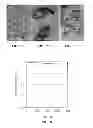Fig. 05 - Metal composite material for attachment to ceramic