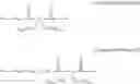 Fig. 04 - Positive photosensitive resin composition