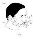 Fig. 06 - Methods and systems for dental procedures