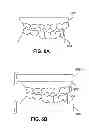 Fig. 07 - Methods and systems for dental procedures