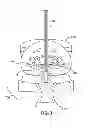 Fig. 08 - Methods and systems for dental procedures